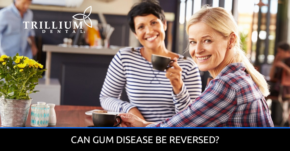 Reverse-Gum-Disease