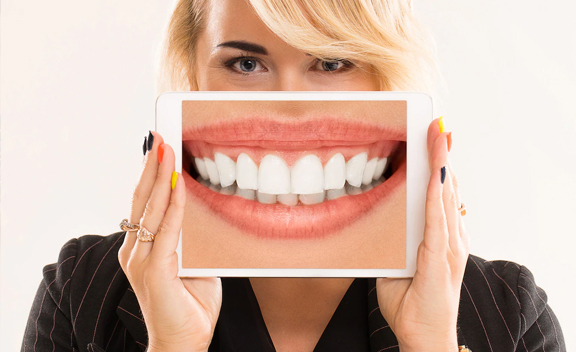 Denture Replacement Orleans