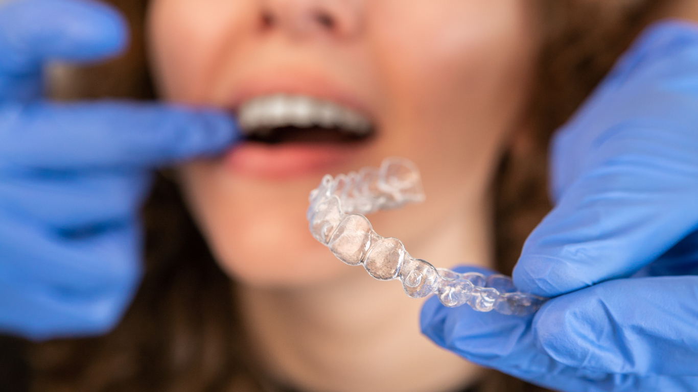 Orthodontist at Trillium Dental fits clear braces on patient