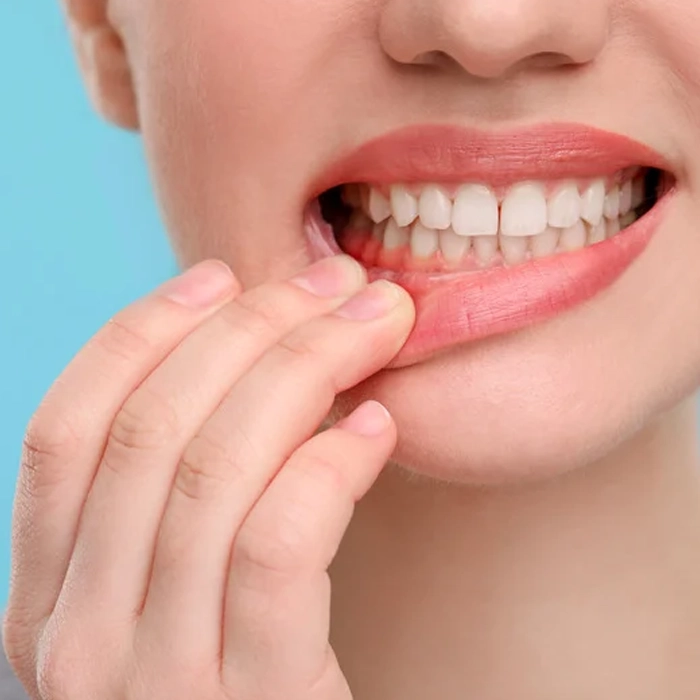 Bad Breath Treatment Orleans